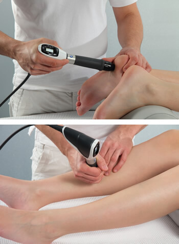 Shockwave Therapy Relieves Heel Spur Pain